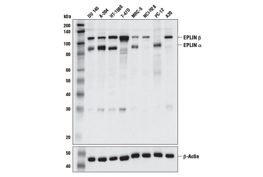 Western Blotting Image 2: EPLIN (D1A7A) Rabbit Monoclonal Antibody