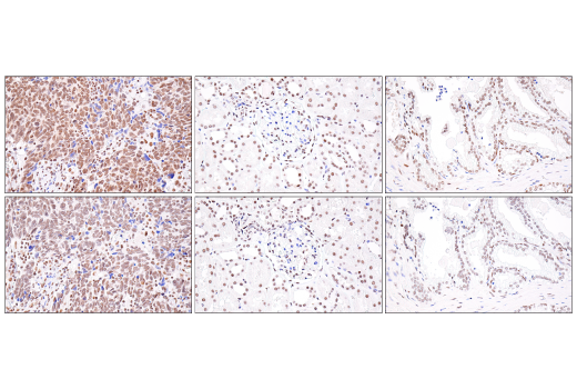 Immunohistochemistry Image 1: BRD4 (E2A7X) Rabbit Monoclonal Antibody