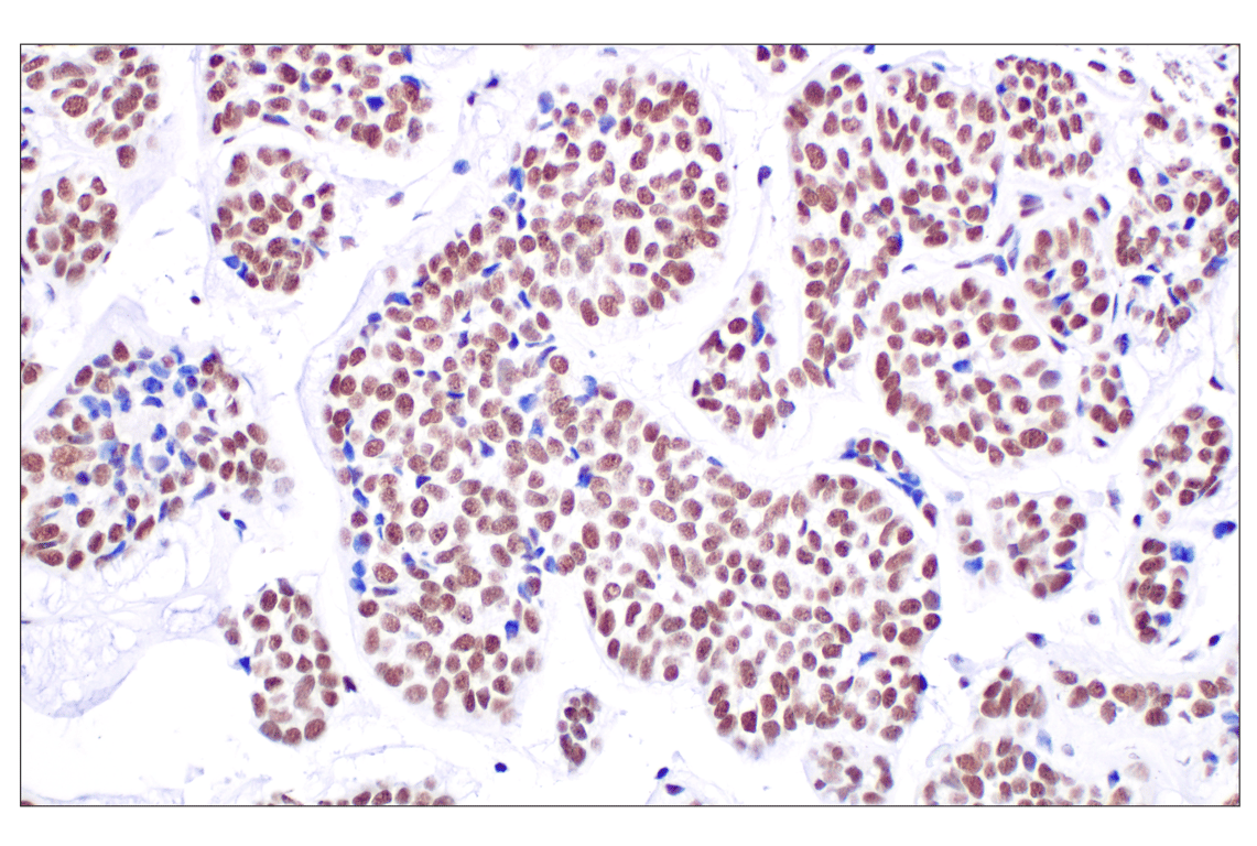 Immunohistochemistry Image 2: HDAC1 (D5C6U) XP<sup>®</sup> Rabbit mAb