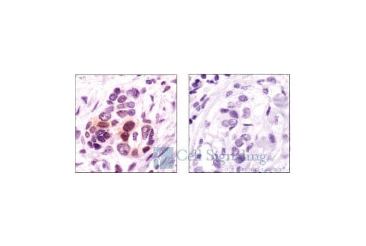 Immunohistochemistry Image 4: Phospho-p38 MAPK (Thr180/Tyr182) (12F8) Rabbit Monoclonal Antibody