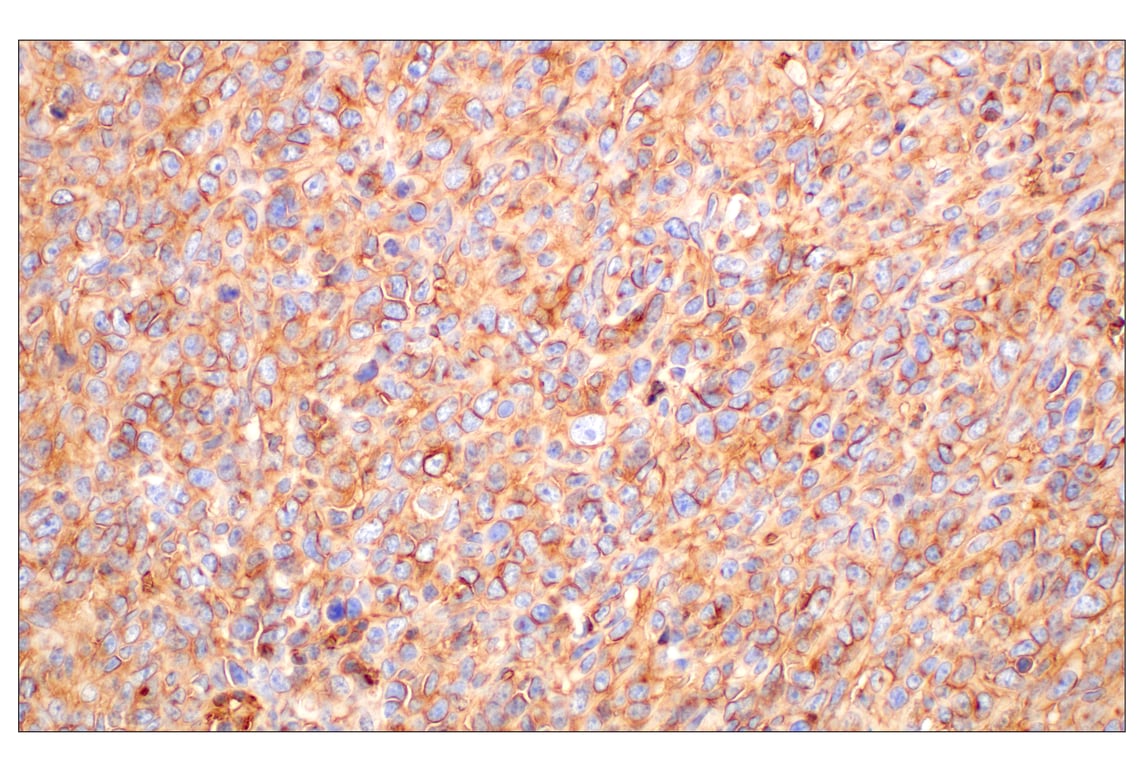 Immunohistochemistry Image 6: CD47 (E2V9V) Rabbit Monoclonal Antibody (BSA and Azide Free)
