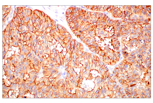 Immunohistochemistry Image 1: JAM-A (E8D2N) Rabbit Monoclonal Antibody