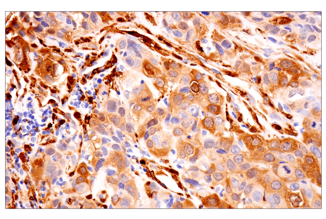 Immunohistochemistry Image 7: Transgelin/TAGLN (F3B7H) Rabbit Monoclonal Antibody