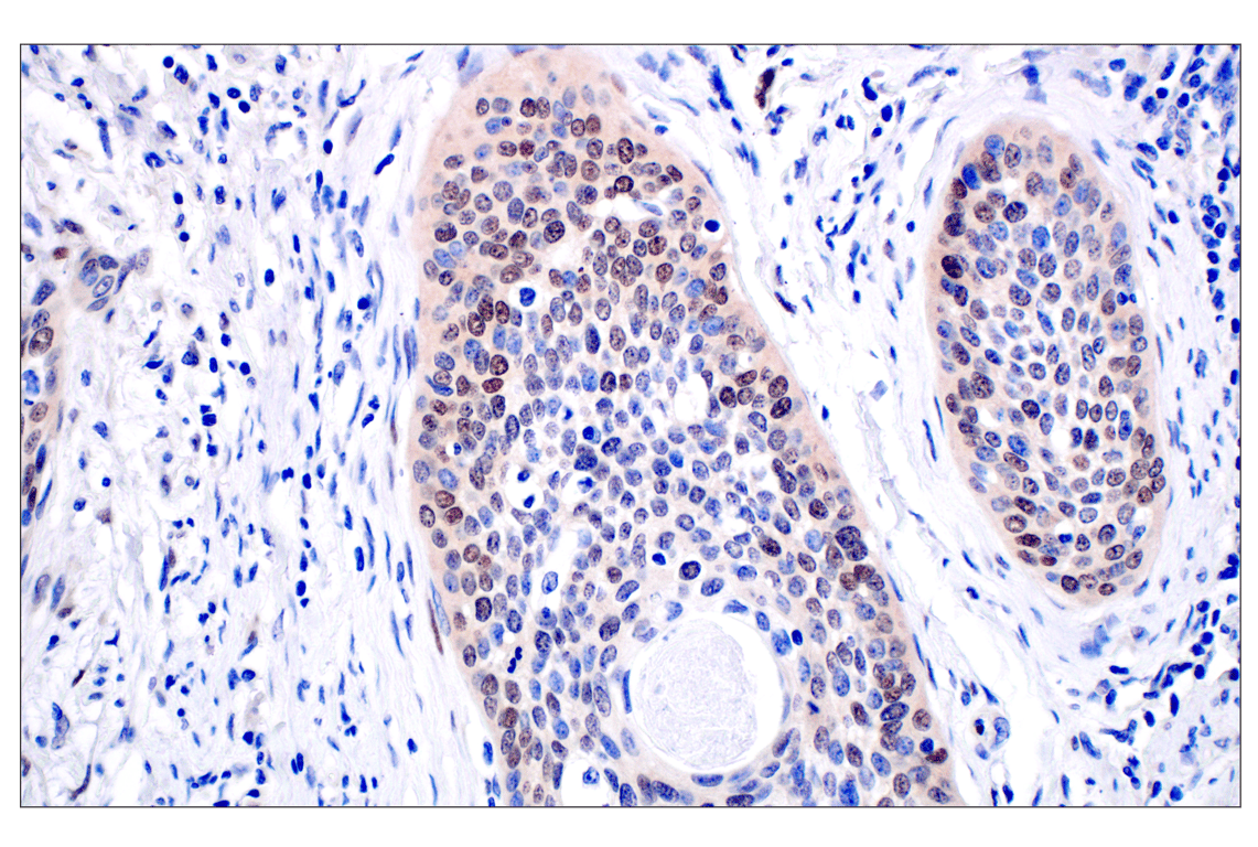 Immunohistochemistry Image 4: ID1 (F2M1J) Rabbit Monoclonal Antibody (BSA and Azide Free)