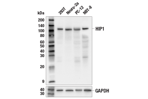 Western Blotting Image 2: HIP1 (E9J9B) Rabbit Monoclonal Antibody