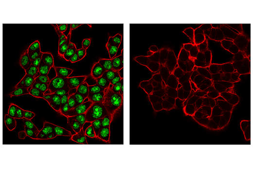 Immunofluorescence Image 1: ADAR1 (E6X9R) Rabbit Monoclonal Antibody (BSA and Azide Free)