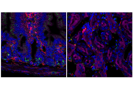Immunofluorescence Image 2: LIMP-2/SCARB2 (E2Z5F) Rabbit Monoclonal Antibody