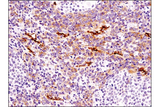 Immunohistochemistry Image 1: Cavin-1 (D1P6W) Rabbit Monoclonal Antibody