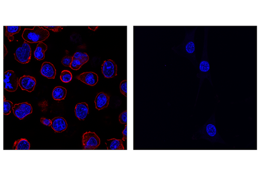 Immunofluorescence Image 1: PD-1 (Intracellular Domain) (D7D5W) XP<sup>®</sup> Rabbit mAb (Alexa Fluor<sup>®</sup> 594 Conjugate)