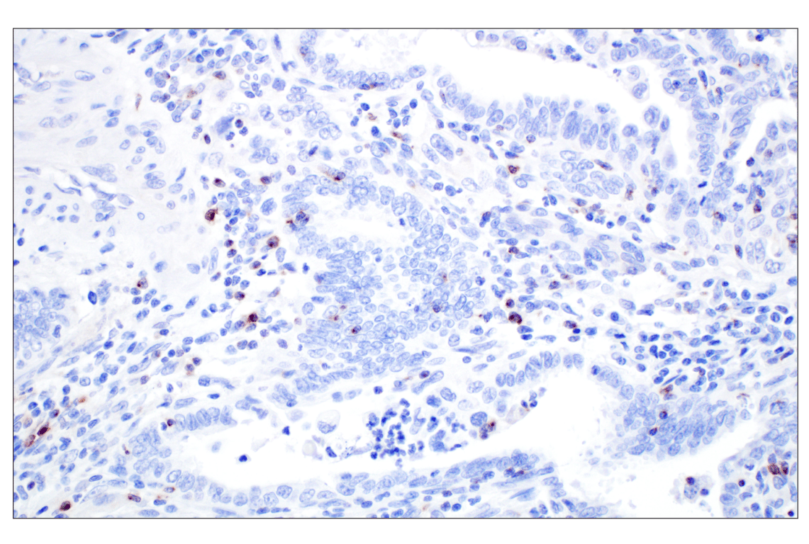 Immunohistochemistry Image 2: CXCL13 (F6A4R) Rabbit Monoclonal Antibody