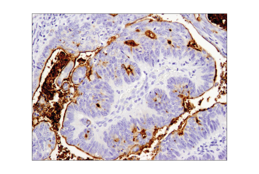 Immunohistochemistry Image 3: MUC1-C (D5K9I) Rabbit Monoclonal Antibody