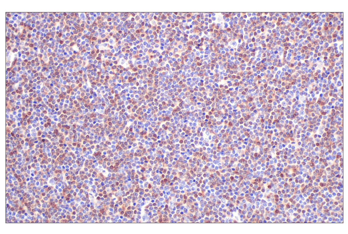 Immunohistochemistry Image 1: TCL1 (F9R1X) Rabbit Monoclonal Antibody