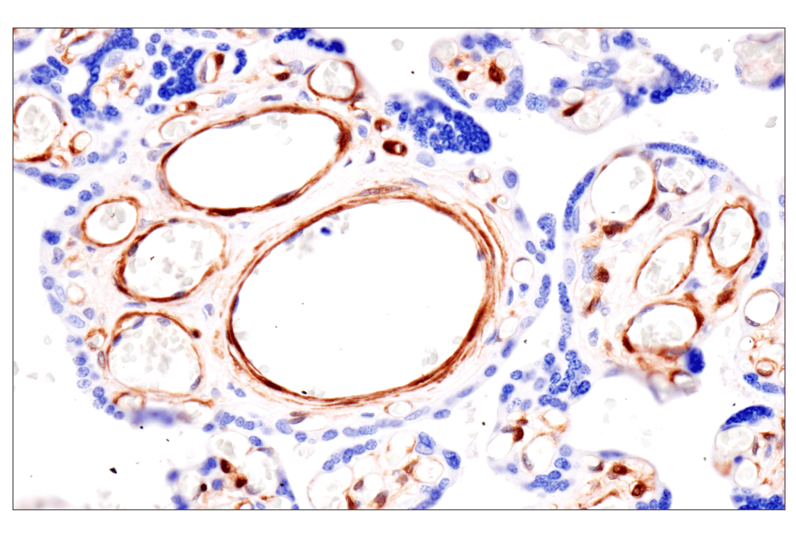 Immunohistochemistry Image 12: PPP1R14A/CPI-17 (F1I6X) Rabbit Monoclonal Antibody