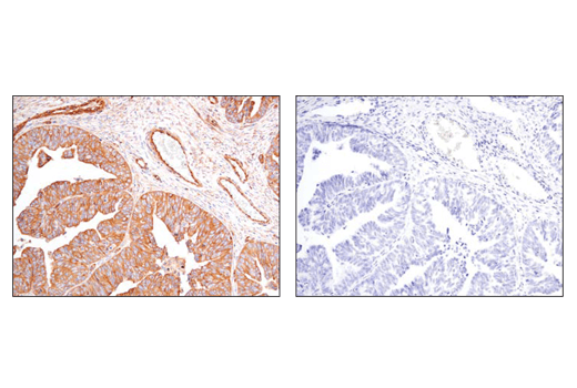 Immunohistochemistry Image 2: alpha-Actinin 4 (D7U5A) Rabbit Monoclonal Antibody 
