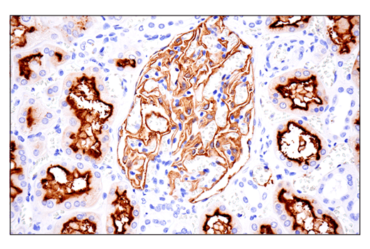 Immunohistochemistry Image 2: CD10/Neprilysin (E5P7S) Rabbit Monoclonal Antibody
