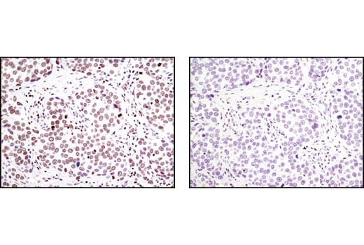 Immunohistochemistry Image 1: LEDGF (C57G11) Rabbit Monoclonal Antibody (BSA and Azide Free)
