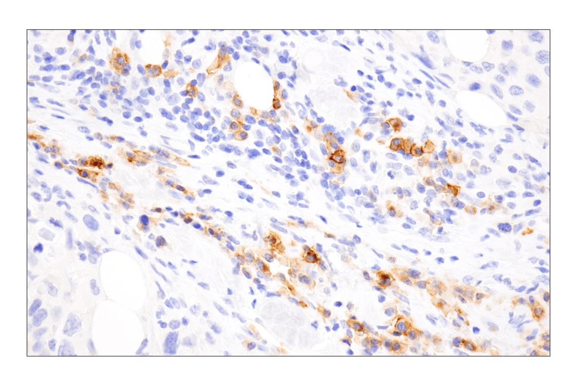 Immunohistochemistry Image 6: TNFRSF17/BCMA (E6D7B) Rabbit Monoclonal Antibody