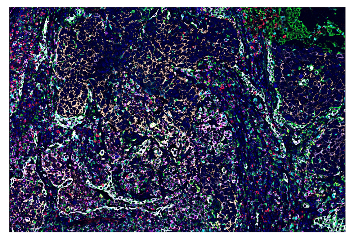 Immunohistochemistry Image 6: XCR1 (D2F8T) & CO-0015-488 SignalStar<sup>™</sup> Oligo-Antibody Pair