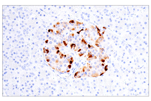 Immunohistochemistry Image 1: IGFBP3 (E6C2E) Rabbit Monoclonal Antibody