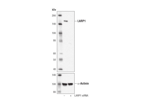 Western Blotting Image 2: LARP1 (D8J4F) Rabbit Monoclonal Antibody