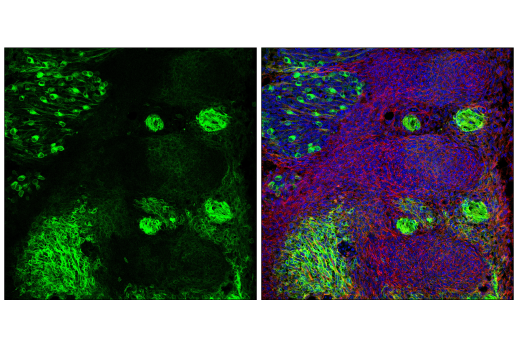 Immunofluorescence Image 2: p75NTR (D4B3) Rabbit Monoclonal Antibody