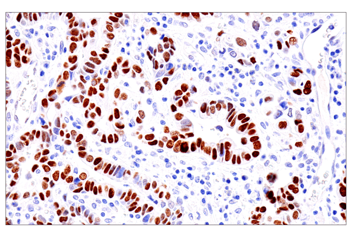 Immunohistochemistry Image 1: GATA-6 (D61E4) XP<sup>®</sup> Rabbit mAb (BSA and Azide Free)