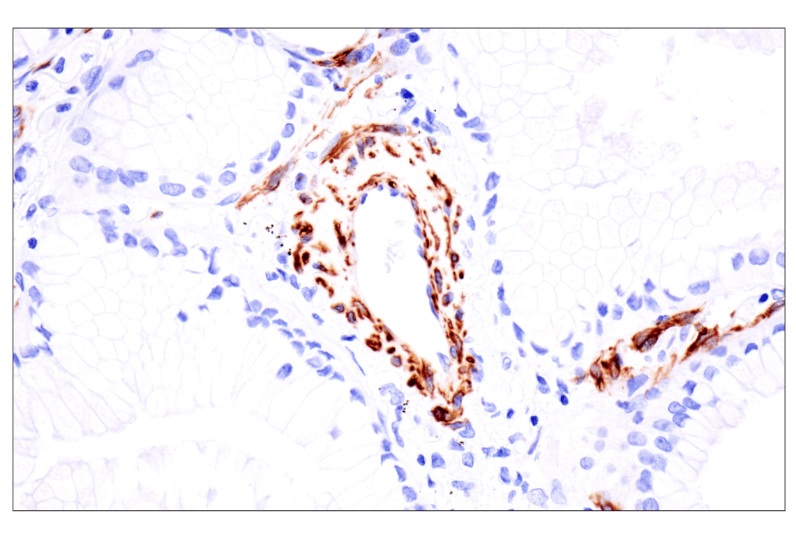 Immunohistochemistry Image 4: Desmin (F5V4I) Rabbit Monoclonal Antibody (BSA and Azide Free)