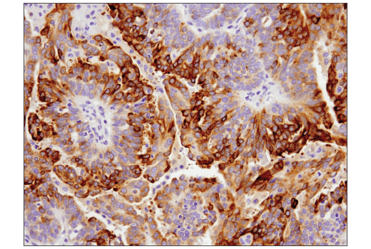 Immunohistochemistry Image 4: GAS6 (D3A3G) Rabbit Monoclonal Antibody