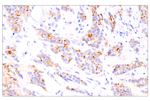 Immunohistochemistry Image 3: DOG1/Anoctamin 1 (K9) Mouse Monoclonal Antibody