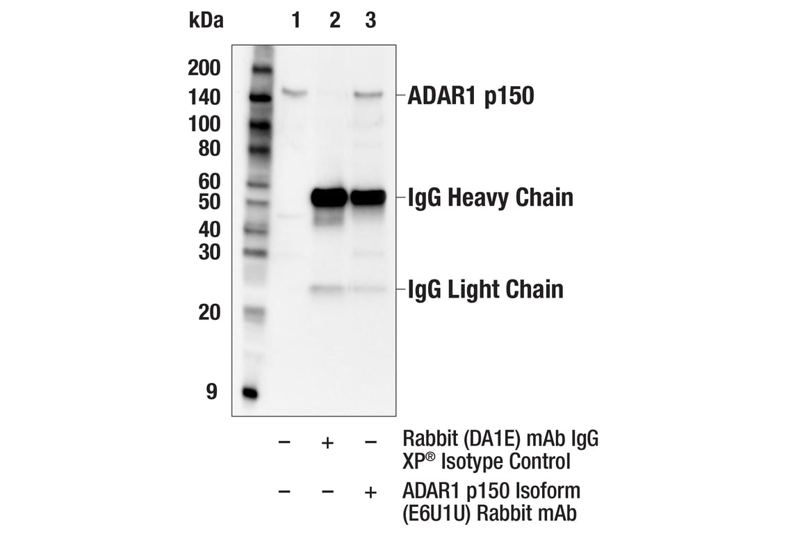 Immunoprecipitation Image 1: ADAR1 p150 Isoform (E6U1U) Rabbit Monoclonal Antibody