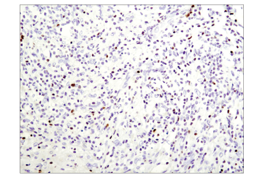 Immunohistochemistry Image 2: T-bet/TBX21 (D6N8B) Rabbit Monoclonal Antibody (BSA and Azide Free)