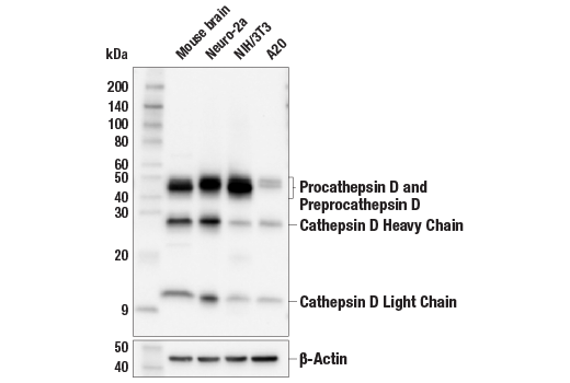 undefined Image 19: PICALM Signaling Antibody Sampler Kit