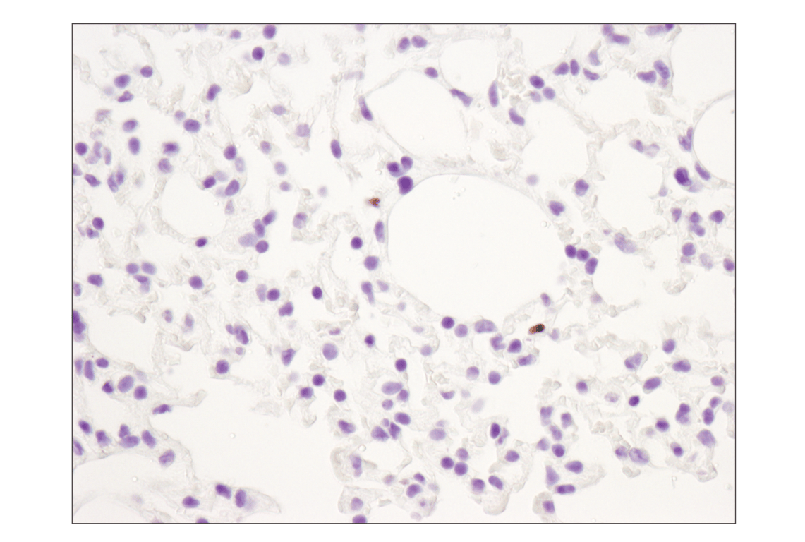 Immunohistochemistry Image 4: FoxP3 (D6O8R) Rabbit Monoclonal Antibody