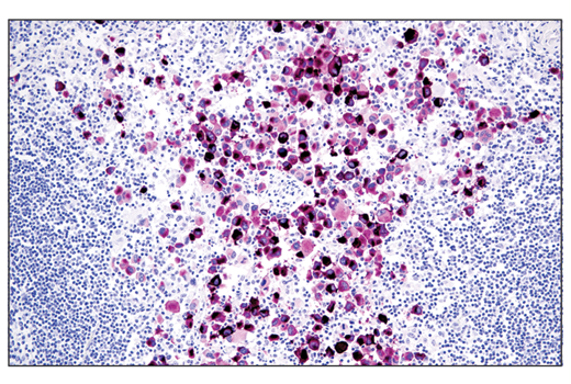 Immunohistochemistry Image 3: SignalStain<sup>®</sup> Vivid Purple Peroxidase Substrate Kit