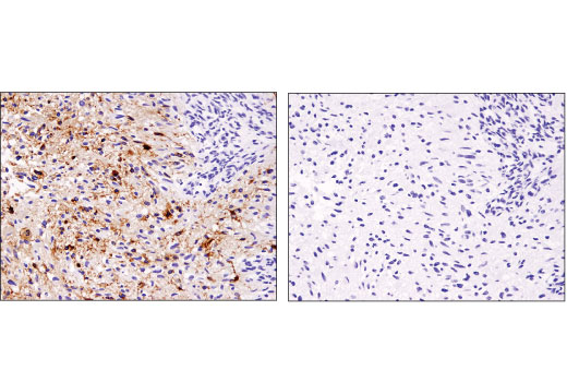 Immunohistochemistry Image 3: EGF Receptor vIII (D6T2Q) Rabbit Monoclonal Antibody