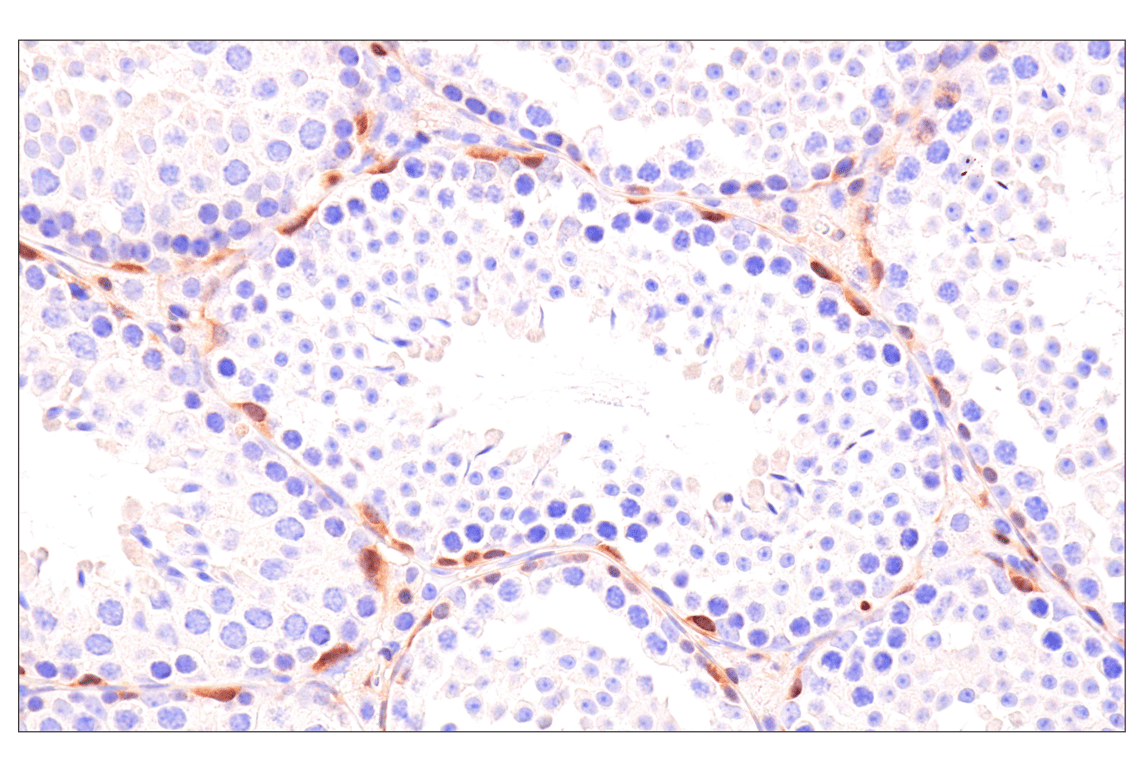 Immunohistochemistry Image 14: CDK6 (E3E3Q) Rabbit Monoclonal Antibody (BSA and Azide Free)