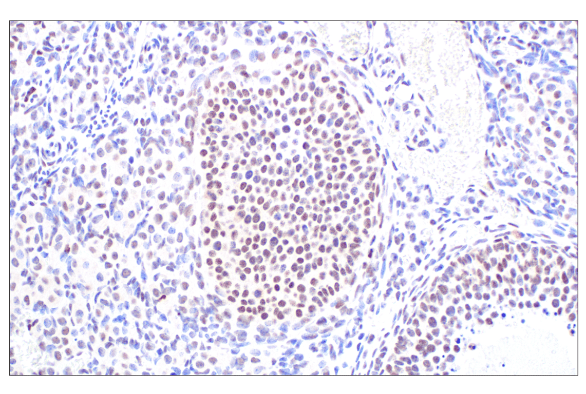undefined Image 35: PPAR gamma Regulated Fatty Acid Metabolism Antibody Sampler Kit