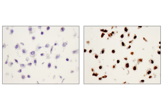 undefined Image 42: Human Reactive M1 vs M2 Macrophage IHC Antibody Sampler Kit