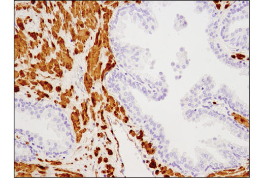 Immunohistochemistry Image 4: Calponin 1 (D8L2T) Rabbit Monoclonal Antibody
