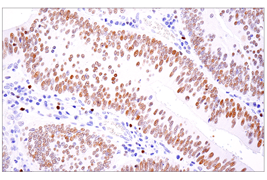 Immunohistochemistry Image 3: SATB1 (E5Z3U) Rabbit Monoclonal Antibody
