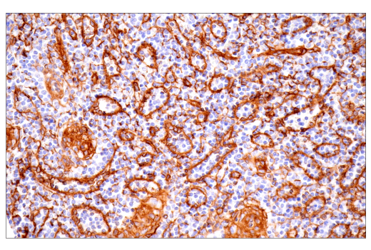 Immunohistochemistry Image 6: Integrin alpha1/CD49a (E9K2J) Rabbit Monoclonal Antibody (BSA and Azide Free)