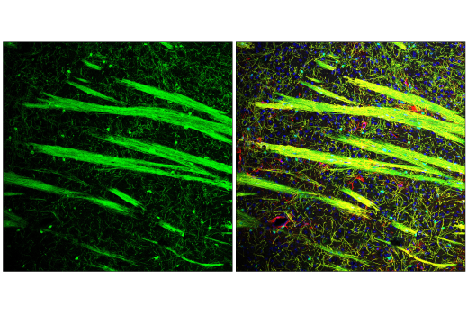 Immunofluorescence Image 4: NDRG1 (E2T5I) Rabbit Monoclonal Antibody