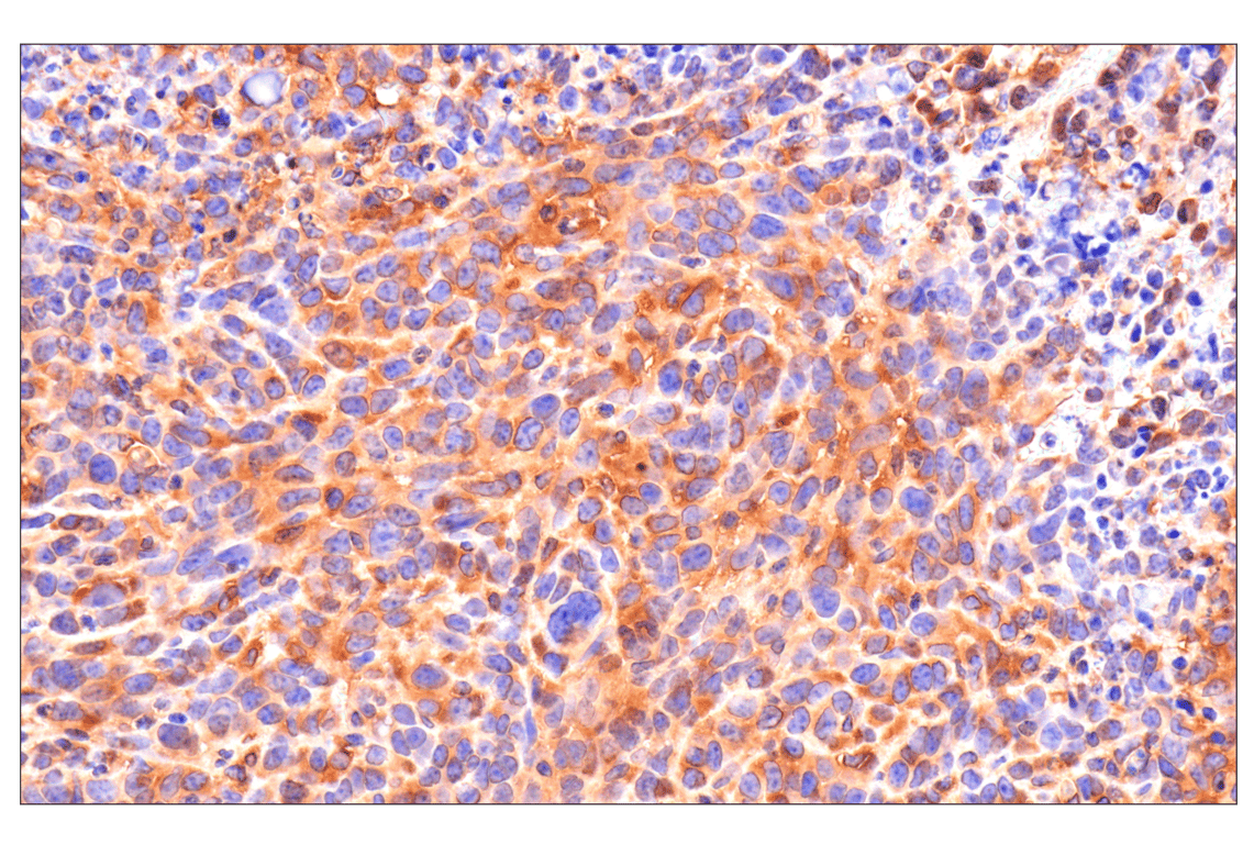 Immunohistochemistry Image 4: Caspase-8 (F5K9P) Rabbit Monoclonal Antibody