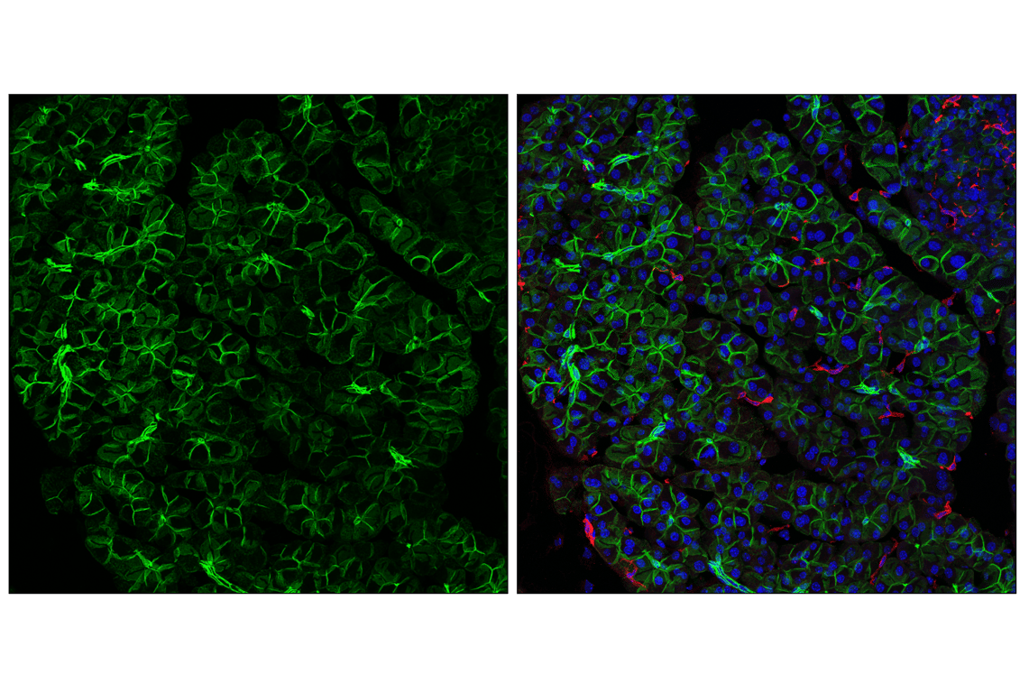 Immunofluorescence Image 3: ALCAM (F3V8Q) Rabbit Monoclonal Antibody