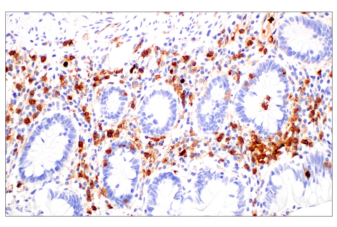 Immunohistochemistry Image 12: CD11b/ITGAM (E3J2F) Rabbit Monoclonal Antibody