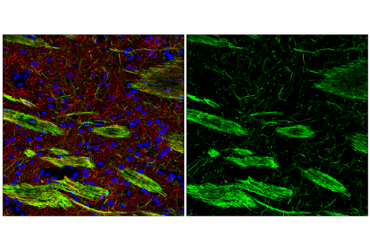 Immunofluorescence Image 1: Neurofilament-M (E7L2T) Rabbit Monoclonal Antibody (BSA and Azide Free)