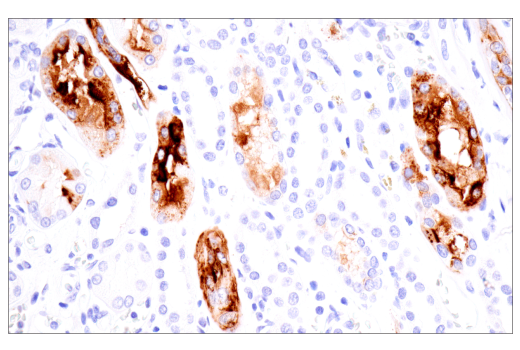 Immunohistochemistry Image 5: CA 19-9 (C241:5:1:4) Mouse Monoclonal Antibody
