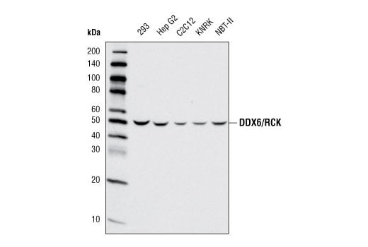 EDC4/Ge-1 Antibody | Cell Signaling Technology