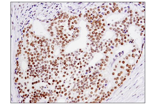 Immunohistochemistry Image 5: TRIM33 (D7U4F) Rabbit Monoclonal Antibody
