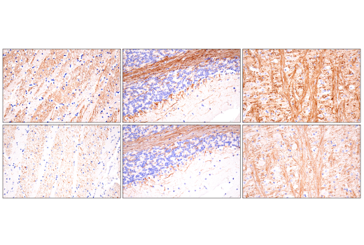 Immunohistochemistry Image 5: Neurofilament-H (E7Z7G) Rabbit Monoclonal Antibody (BSA and Azide Free)